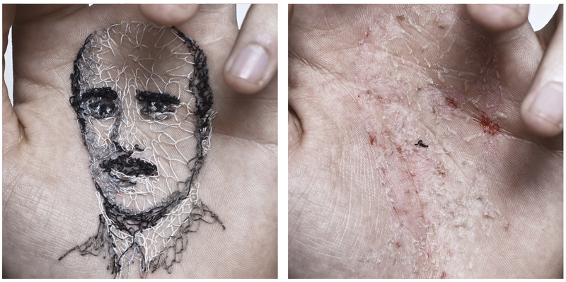 Illustration for article titled Artist embroiders portraits into his own flesh—and then tears them out